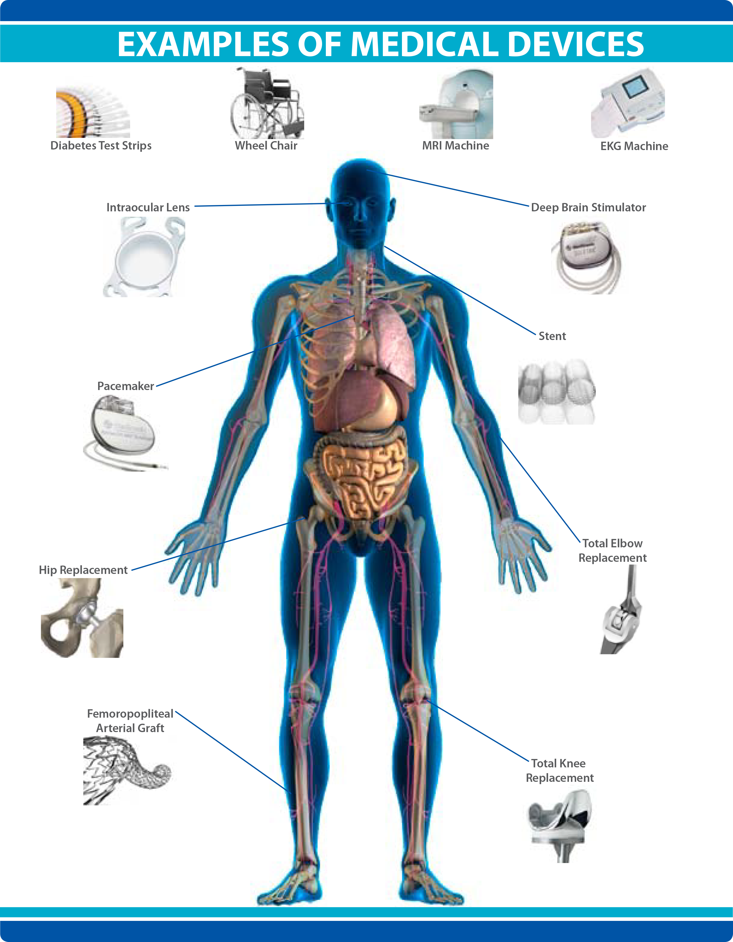 what-is-a-medical-device-life-changing-innovation